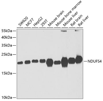 Anti-NDUFS4 Antibody (CAB6390)