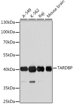 Anti-TARDBP Antibody (CAB0538)