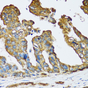 Anti-SLC25A13 Antibody (CAB12557)