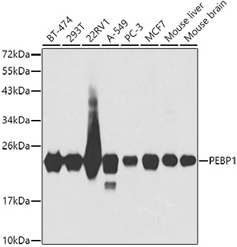 Anti-PEBP1 Antibody (CAB0578)