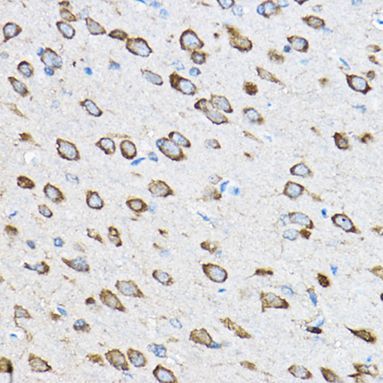 Anti-RPL23 Antibody (CAB4292)