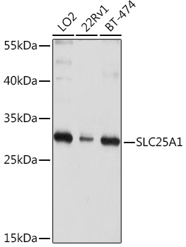 Anti-SLC25A1 Antibody (CAB10247)