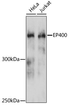 Anti-EP400 Antibody (CAB12151)