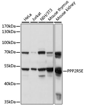 Anti-PPP2R5E Antibody (CAB15084)