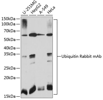 Anti-Ubiquitin Antibody (CAB19686)