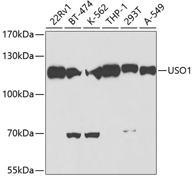 Anti-USO1 Antibody (CAB2796)