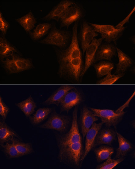 Anti-BGLAP Antibody (CAB6205)