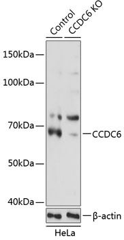 Anti-CCDC6 Antibody [KO Validated] (CAB19901)