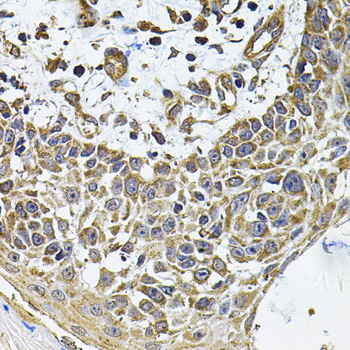 Anti-ICOSL Antibody (CAB7080)