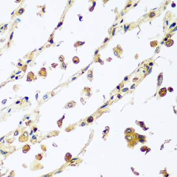 Anti-VPS4A Antibody (CAB7096)