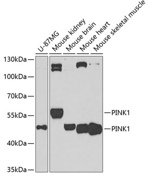 Anti-PINK1 Antibody (CAB7131)