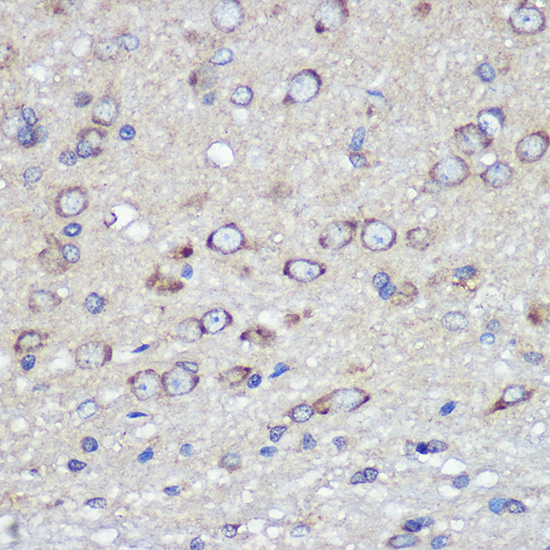 Anti-F11R Antibody (CAB1241)