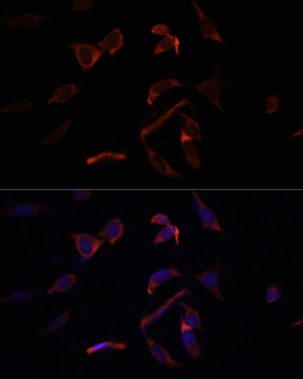 Anti-MCL1 Antibody (CAB0434)