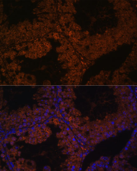 Anti-TPD52L3 Antibody (CAB15545)