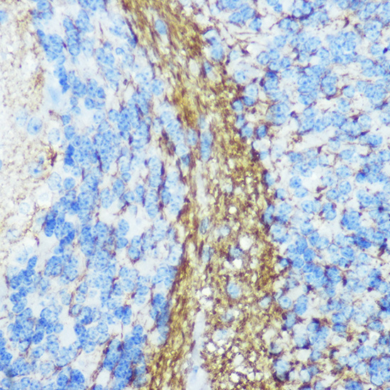 Anti-NEFM Antibody (CAB16405)