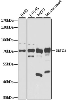 Anti-SETD3 Polyclonal Antibody (CAB8071)