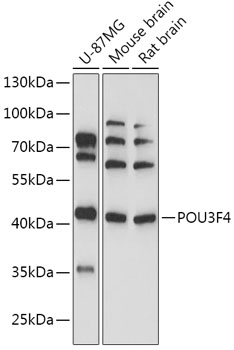 Anti-POU3F4 Antibody (CAB17521)