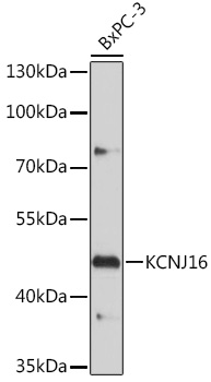 Anti-KCNJ16 Antibody (CAB18635)