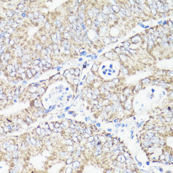 Anti-VDAC1 / Porin Antibody (CAB15735)