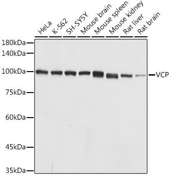 Anti-VCP Antibody (CAB2795)