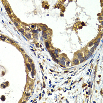 Anti-CTSS Antibody (CAB13482)