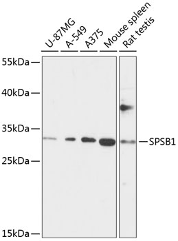 Anti-SPSB1 Antibody (CAB13886)