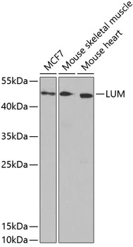 Anti-LUM Antibody (CAB5352)