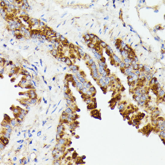 Anti-PTP4A2 Antibody (CAB15335)