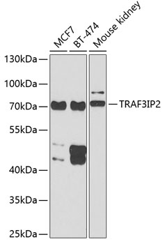 Anti-TRAF3IP2 Antibody (CAB6776)