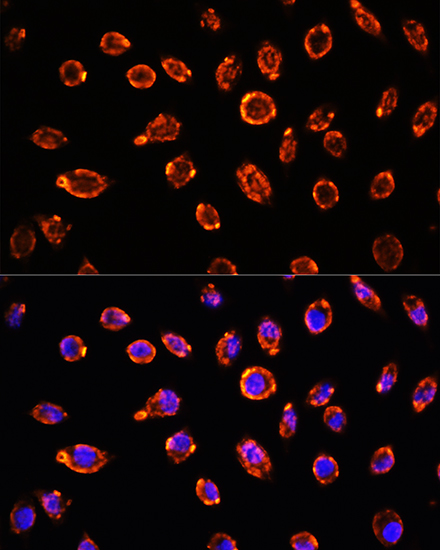 Anti-BNP Antibody (CAB2179)