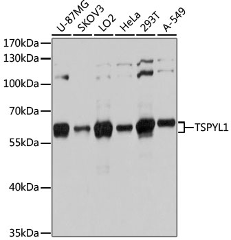 Anti-TSPYL1 Antibody (CAB12174)