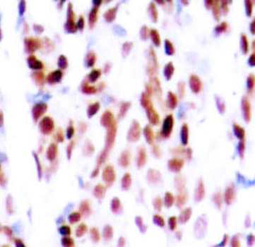 Anti-Phospho-JUNB-S79 Antibody (CABP0376)