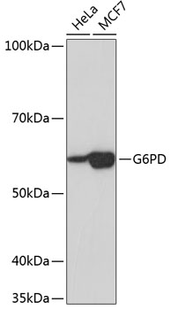 Anti-G6PD Antibody