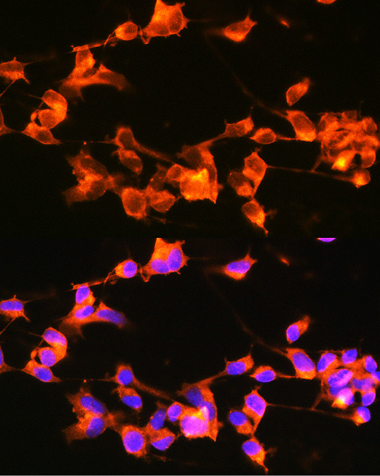 Anti-DCX Antibody (CAB17469)