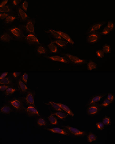 Anti-NSDHL Antibody [KO Validated] (CAB16893)