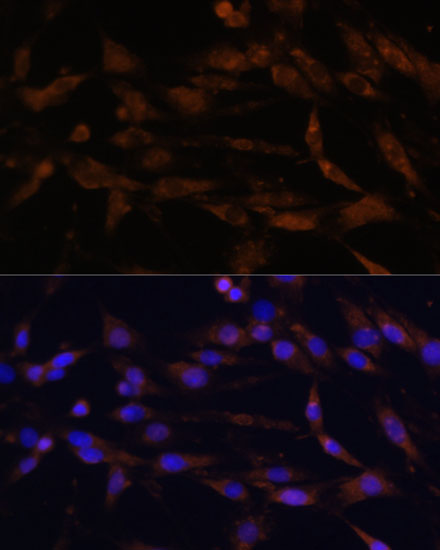 Anti-CD44 Antibody (CAB16807)