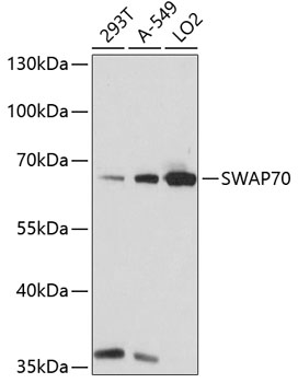 Anti-SWAP70 Antibody (CAB14857)