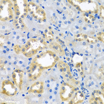 Anti-NDUFB10 Antibody (CAB3982)