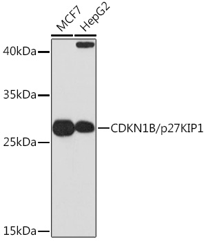 Anti-CDKN1B/p27KIP1 Antibody [KO Validated] (CAB0290)