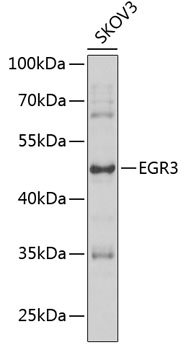 Anti-EGR3 Antibody (CAB7669)