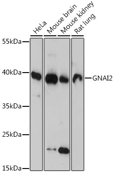 Anti-GNAI2 Antibody (CAB14547)