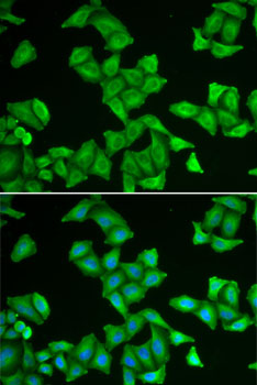 Anti-COX5A Antibody (CAB6437)