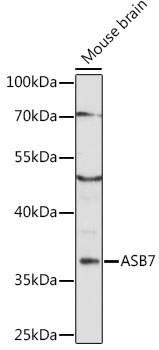 Anti-ASB7 Antibody (CAB16596)