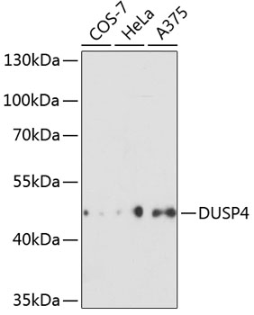 Anti-DUSP4 Antibody (CAB2726)