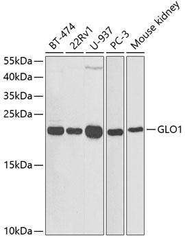 Anti-GLO1 Antibody (CAB1932)