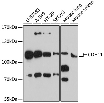 Anti-Cadherin-11 Polyclonal Antibody (CAB8110)