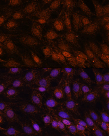 Anti-USP18 Antibody (CAB16739)