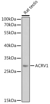 Anti-ACRV1 Polyclonal Antibody (CAB8098)