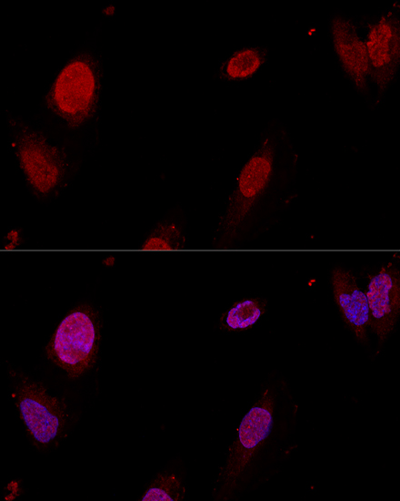 Anti-PTBP1 Antibody (CAB1831)