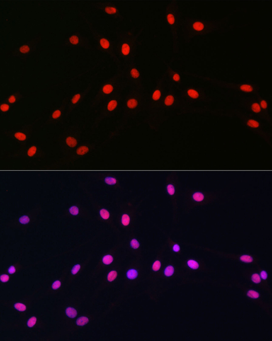 Anti-SOX10 Antibody (CAB15100)